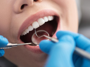 Dentist in Baton Rouge Foods to Avoid After You Have a Cavity Filled