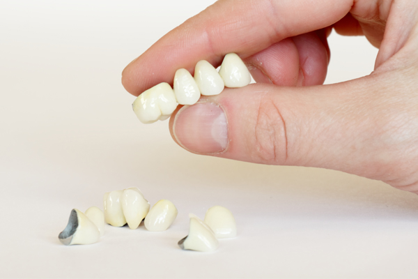 Dentist in Baton Rouge When to Get Dental Crowns