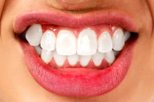 Dentist in Baton Rouge Teeth Grinding and its Consequences