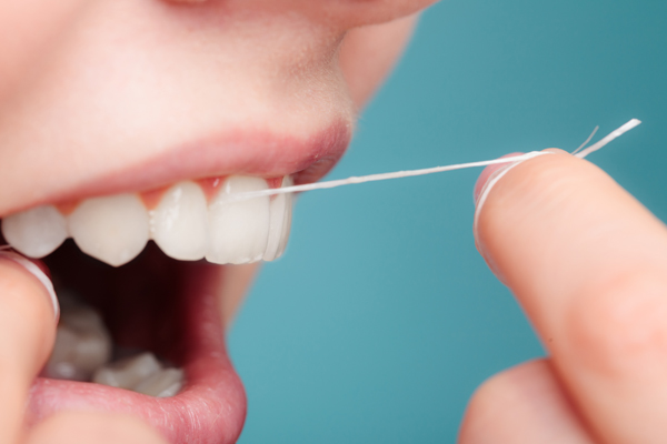 Dentist in Baton Rouge Keeping Your Teeth Healthy in Between Dental Visits
